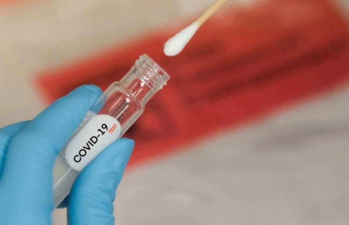 В Саратовской области подтверждено 117 новых случаев заболевания коронавирусом