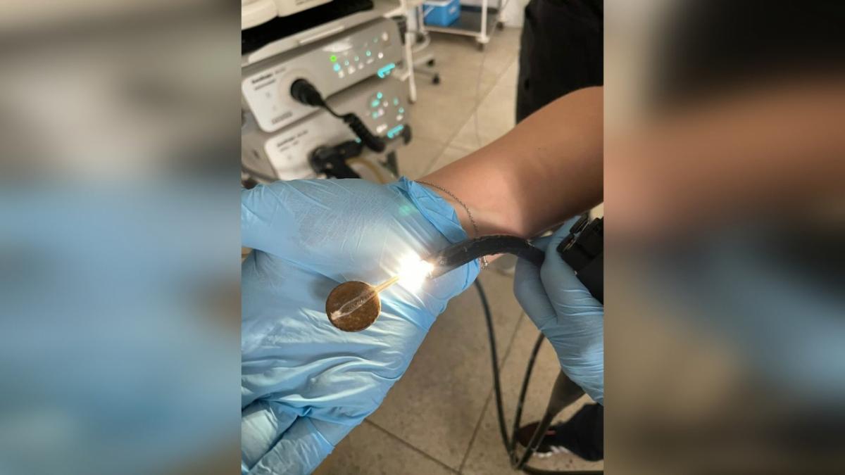 В Энгельсе врачи извлекли монету из желудка 2-летнего ребенка