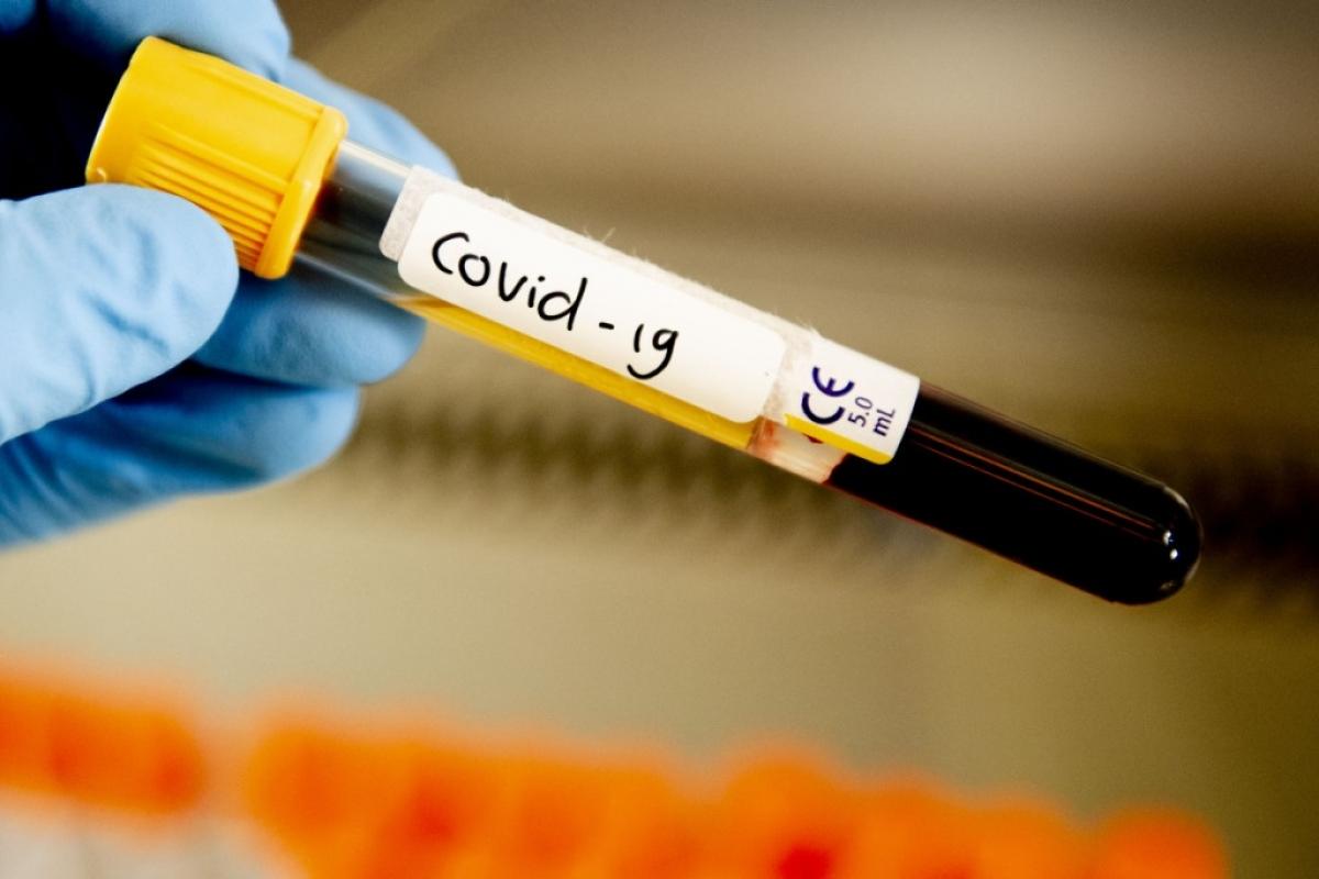 COVID-19 в Саратовской области: 121 заболевший за последние сутки