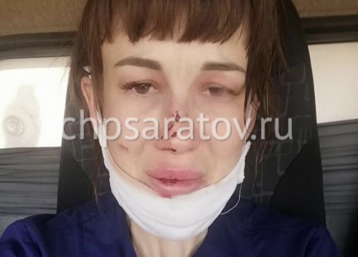В Саратовской области задержан пациент, сломавший нос фельдшеру скорой помощи 