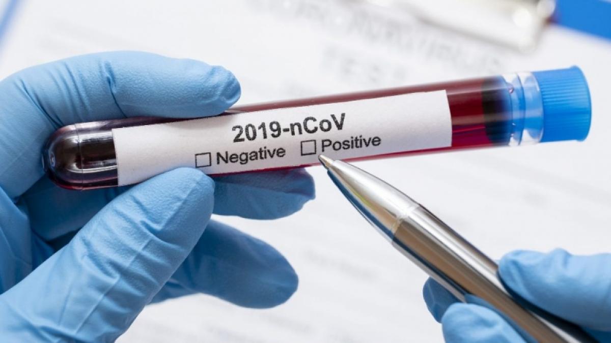 Роспотребнадзор назвал причины ошибок при тестах на коронавирус